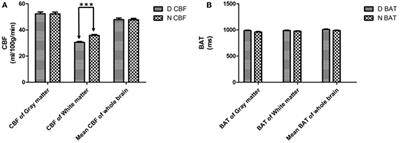 Cerebral Hemodynamic and White Matter Changes of Type 2 Diabetes Revealed by Multi-TI Arterial Spin Labeling and Double Inversion Recovery Sequence
